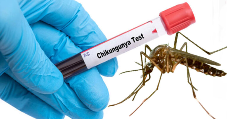 ಚಿಕೂನ್ ಗುನ್ಯಾಗೆ ಲಸಿಕೆ ಕಂಡು ಹಿಡಿದ ಅಮೆರಿಕ