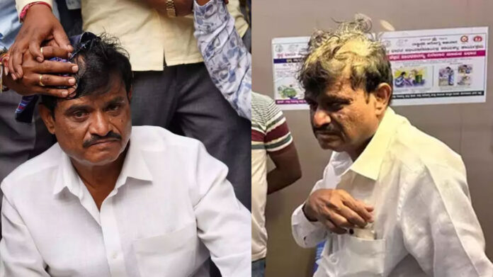 BJP MLA Munirathana faces egg attack in Bengaluru, blames Dy CM Shivakumar