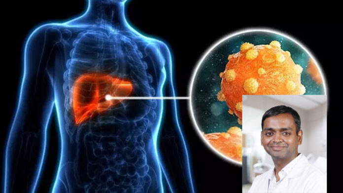 Hepatitis